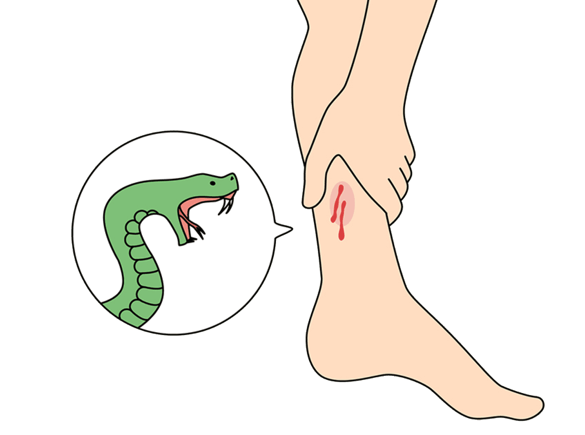 Snake bite illustration